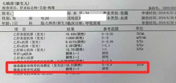 查传染病四项挂什么科多少钱,传染四项检查很丢人吗?-第3张图片 查传染病四项挂什么科多少钱,传染四项检查很丢人吗?-第3张图片
